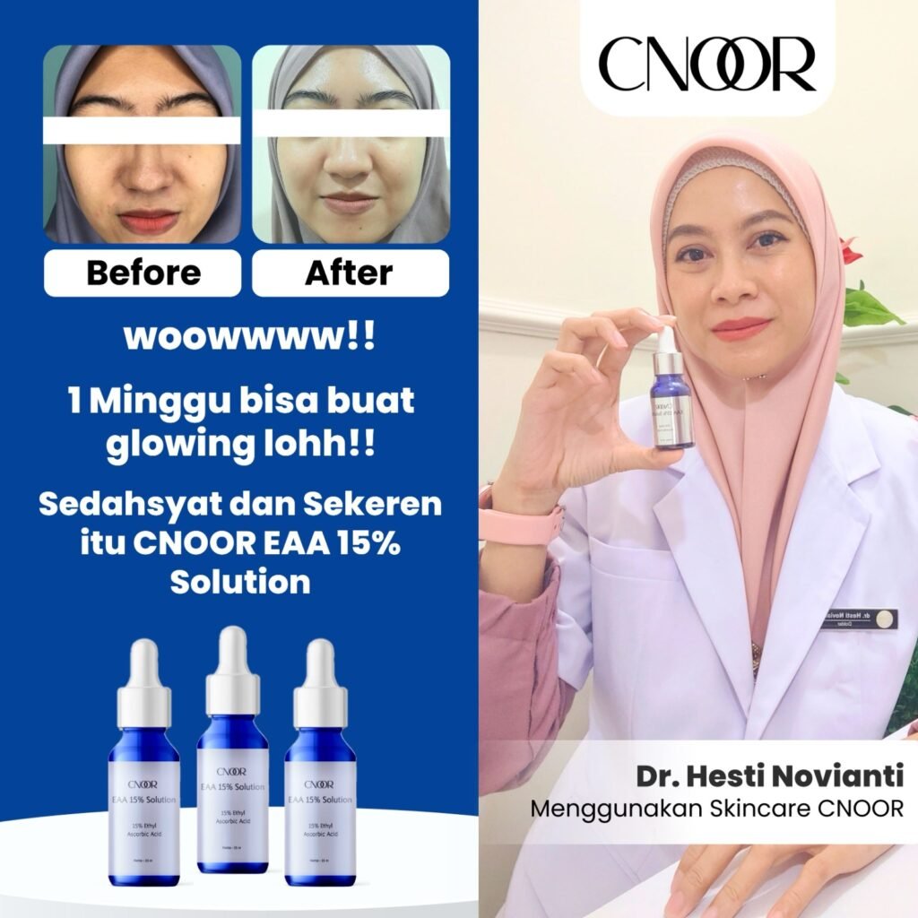 Testimoni Skincare Cnoor Official dari Dokter Hesti Novianti