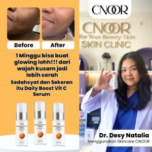 Kulit Putih, Muda dan Bercahaya dengan Serum Vitamin C 10%